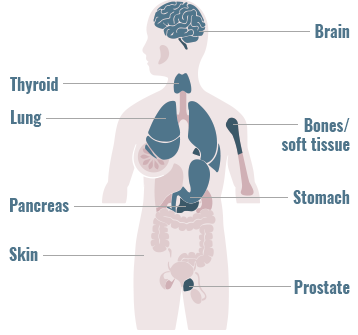 Distribution of BRAF/CRAF gene fusions across primary tumor sites graphic